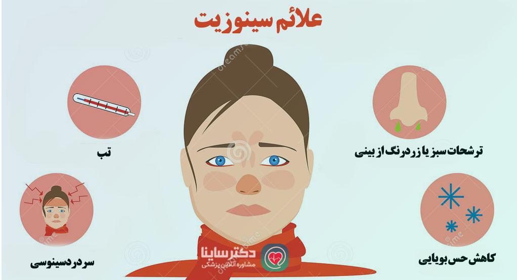 علائم سینوزیت