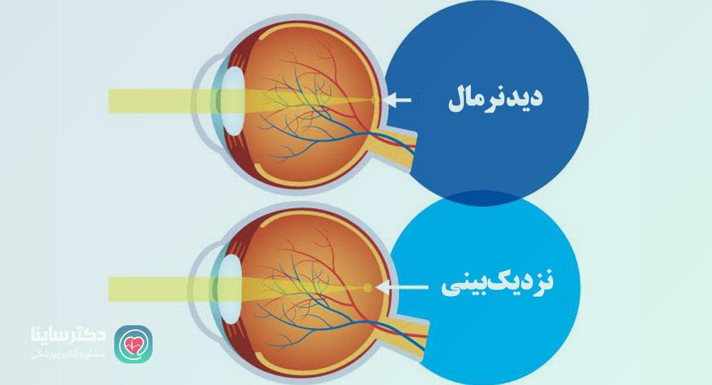 نزديك بيني