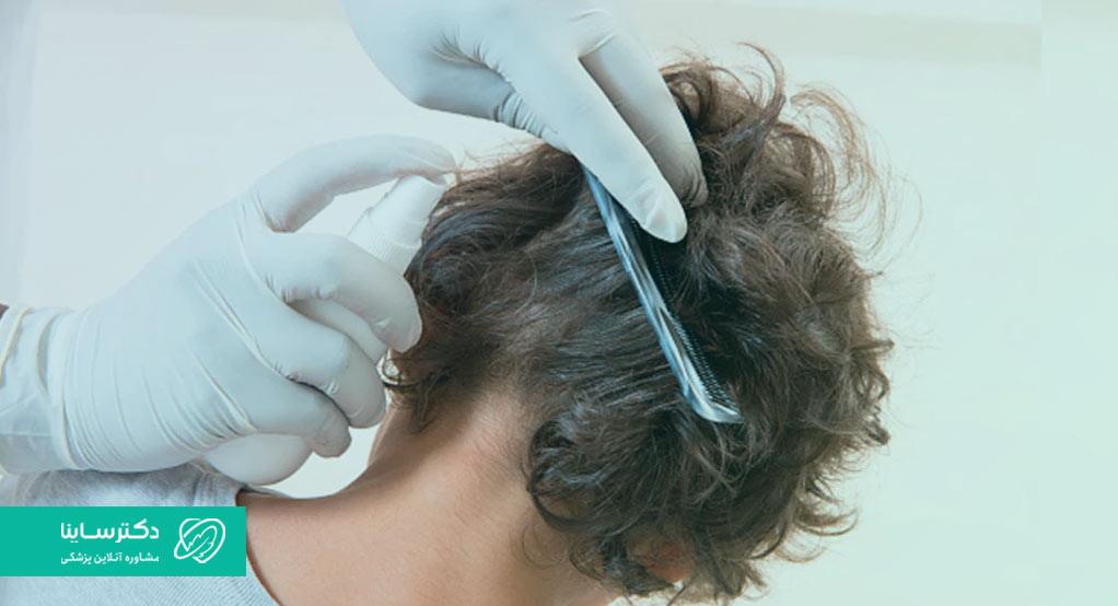 شامپو ضد شپش