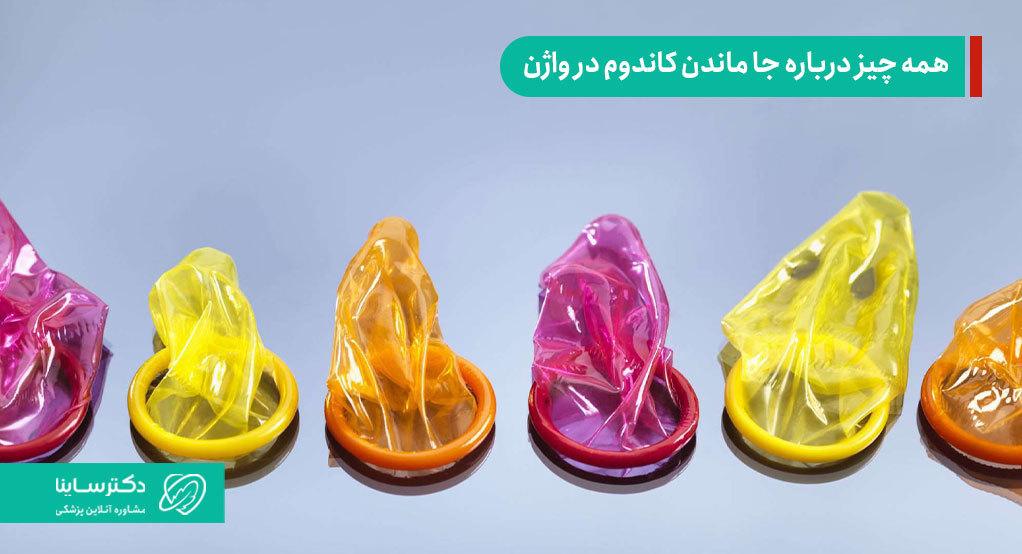 جا ماندن کاندوم در واژن