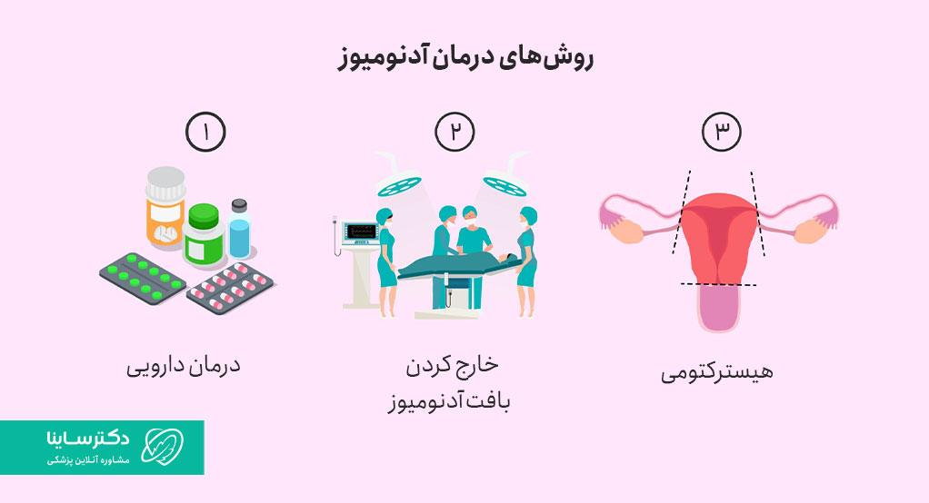 درمان دارویی و هیسترکتومی برخی ا ز روشهای درمان آدنومیوز است.