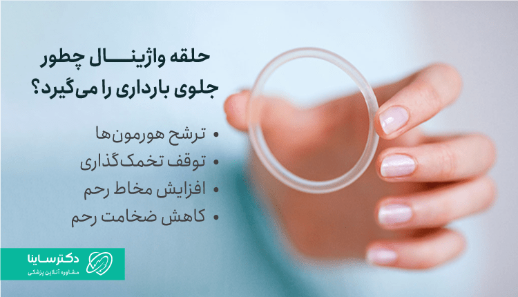 حلقه واژینال چگونه کار میکند؟
