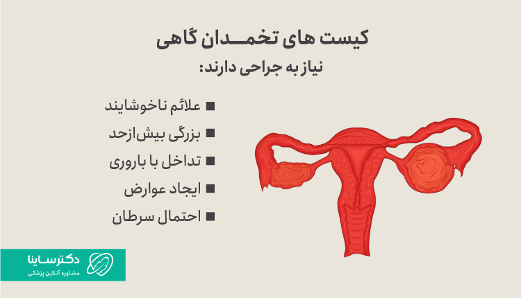 کیستهای تخمدان در شرایط خاصی نیاز به جراحی دارند.