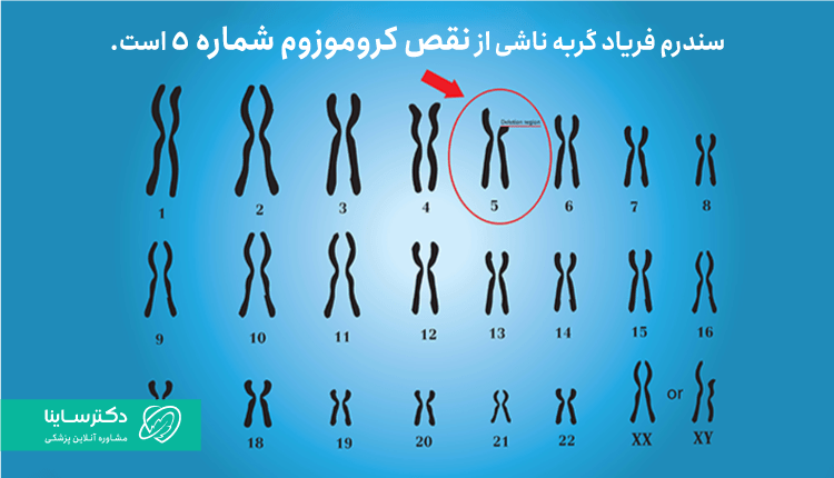 سندروم فریاد گربه به علت نقص کروموزم شماره ۵ است.