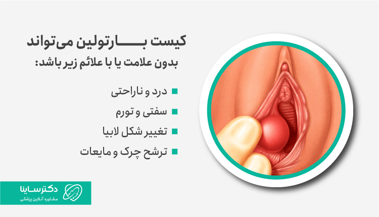 علائم کیست بارتولین