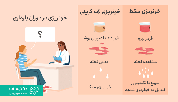 تفاوت خونریری در بارداری و خونریزی لانه گزینی و خونریزی سقط