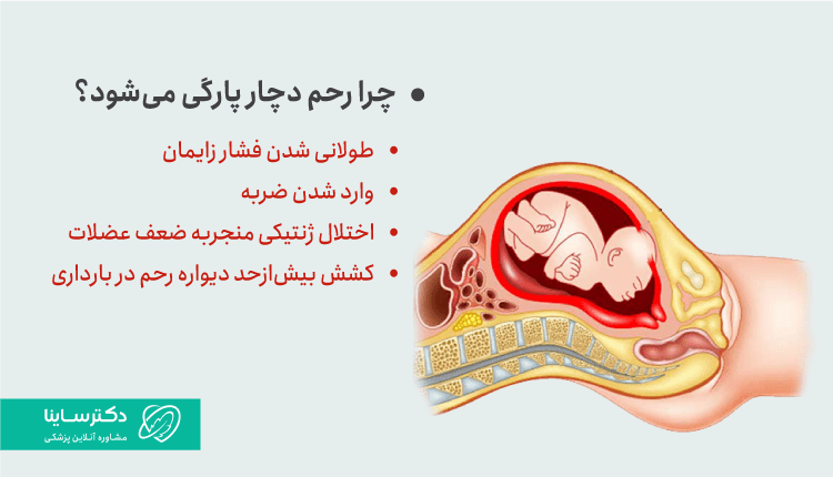 علت پاره شدن رحم