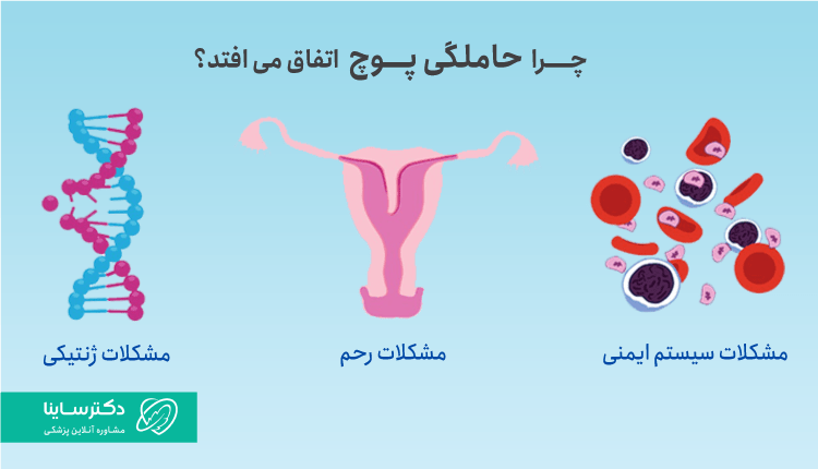 علت حاملگی پوچ