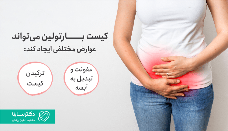 عوارض کیست بارتولین