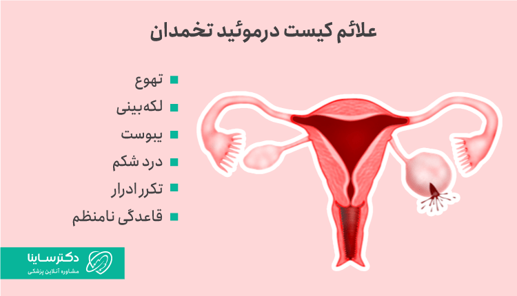 علائم کیست درموئید تخمدان