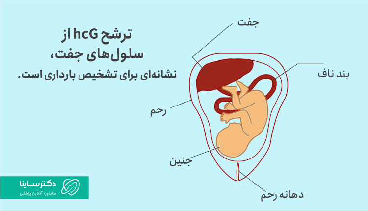 تشخیص بارداری به کمک آزمایش ادرار بارداری