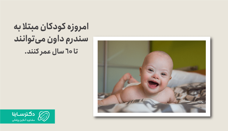 سندروم داون