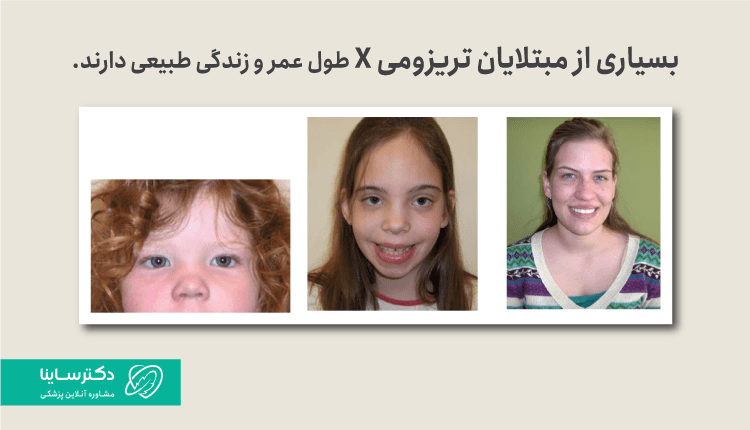 تریزومی X
