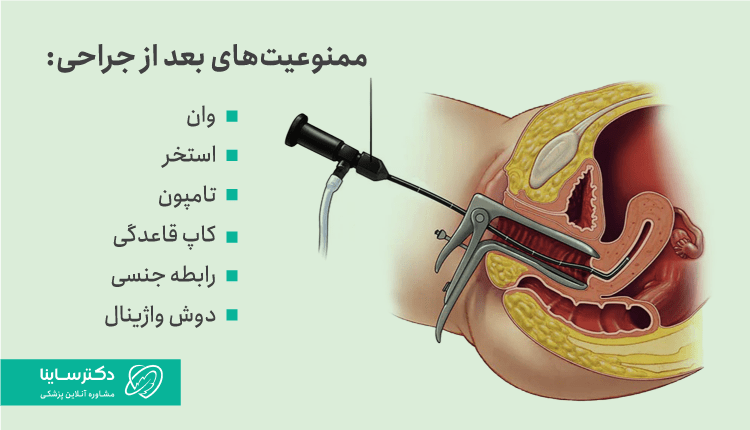 ممنوعیتهای بعد از جراحی پولیپ رحم