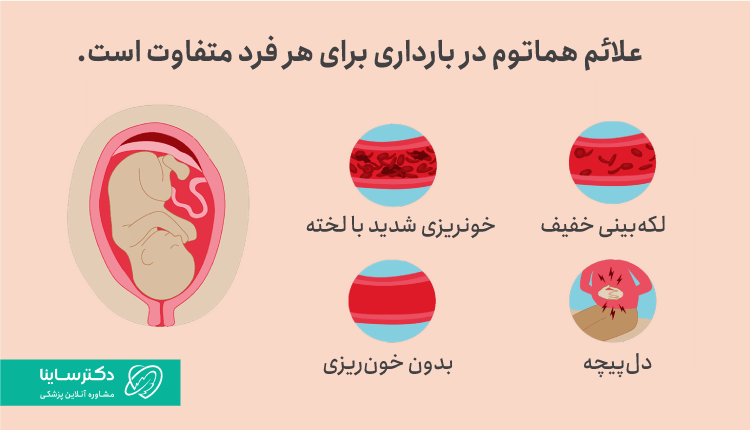 علائم هماتوم در بارداری