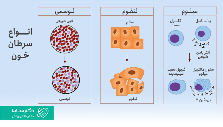 انواع سرطان خون