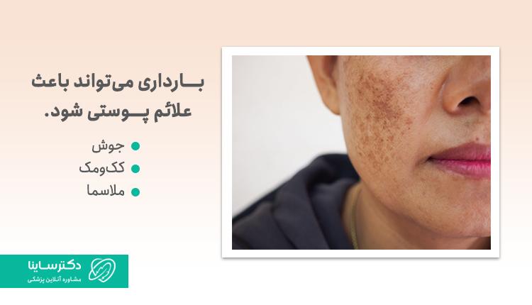 علائم بارداری از روی چهره
