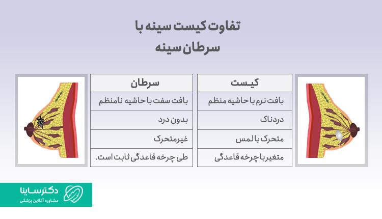 تفاوت کیست سینه و سرطان سینه