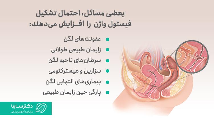 علت فیستول واژن