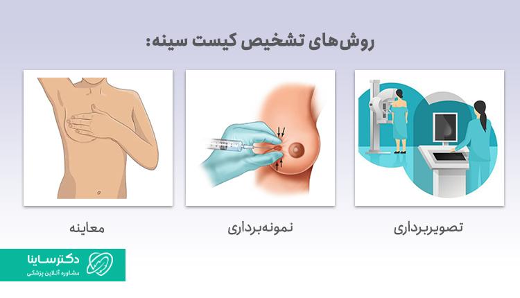 روشهای تشخیص کیست سینه
