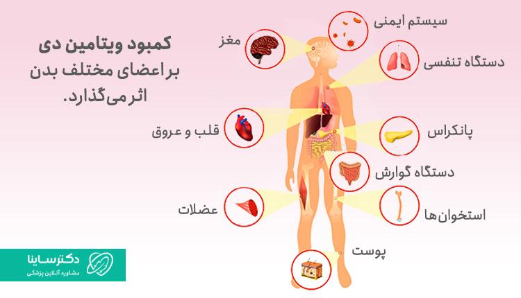 کمبود ویتامین دی بر اعضای مختلف بدن تاثیر میگذارد.