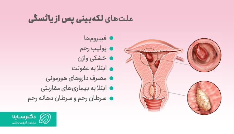 علل لکهبینی بعد از یائسگی