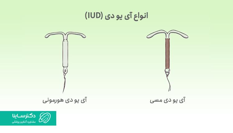 آی یو دی مسی و هورمونی
