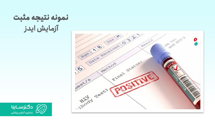 برگه آزمایش ایدز
