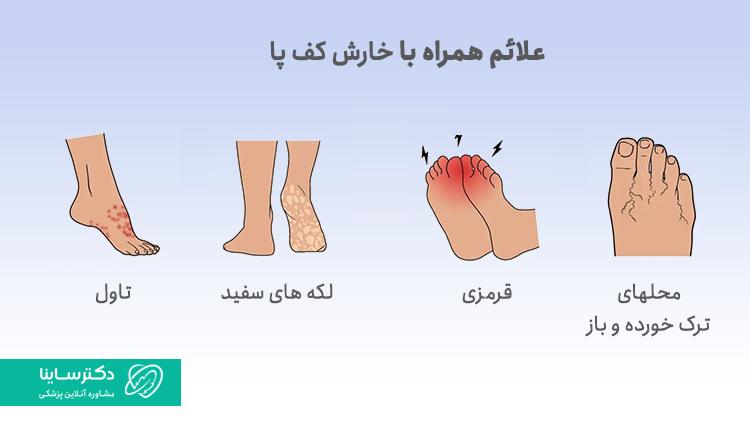 علائم خارش کف پا