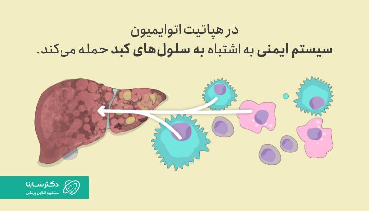در هپاتیت اتوایمیون سیستم ایمنی به اشتباه به سلولهای کبد حمله میکند.
