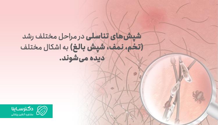 شپش تناسلی در مراحل مختلف رشد، به اشکال مختلفی دیده میشود.