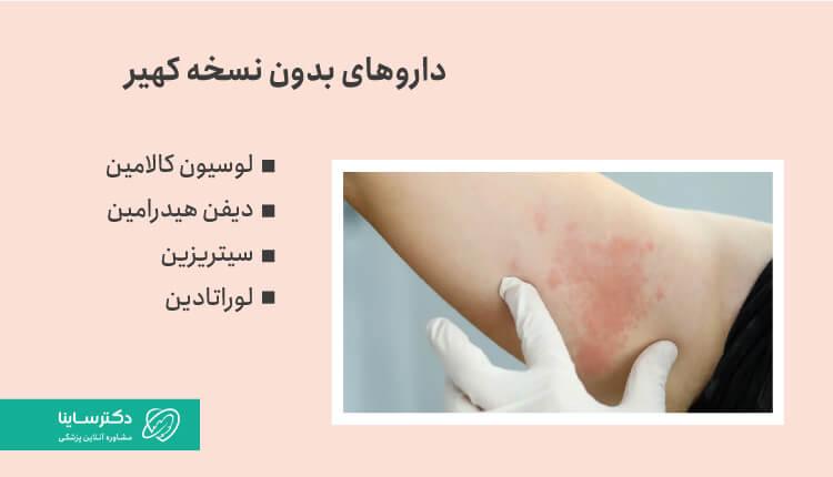 داروهای بدون نسخه برای درمان خانگی کهیر