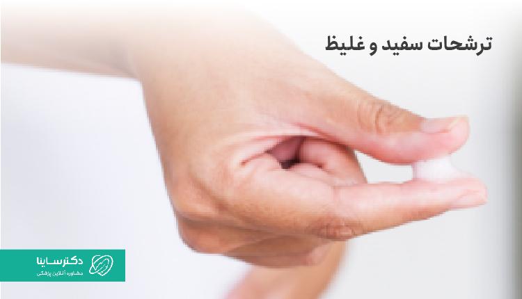 ترشحات سفید و غلیظ واژن طبیعی است.