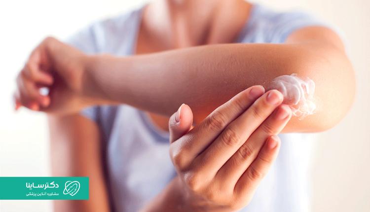 پماد بتامتازون به صورت موضعی مصرف میشود.