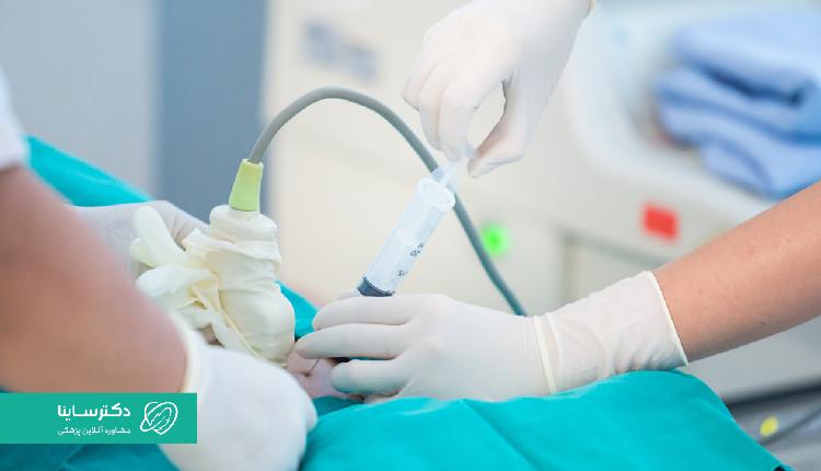آزمایش آمنیوسنتز، نمونهگیری از مایع آمنیوتیک است.