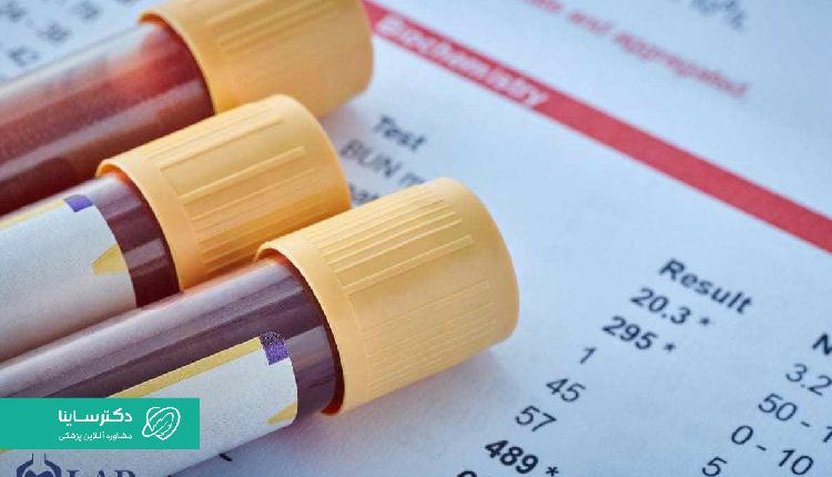 برای تشخیص تب دانگ، آزمایش خون لازم است.