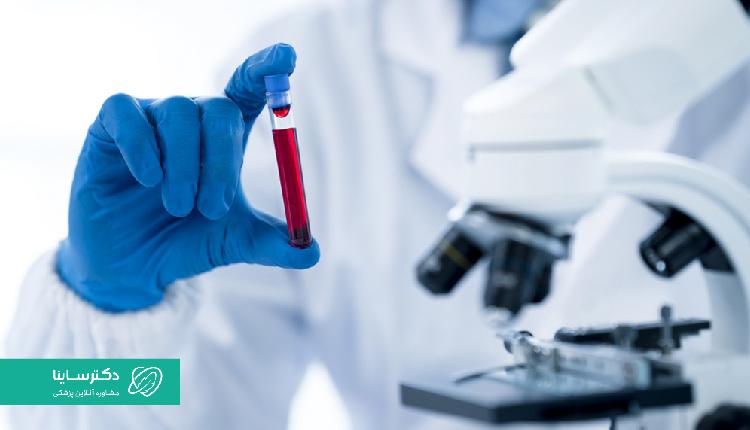 آزمایش خون، از مهمترین آزمایشات غربالگری دوم بارداری است.