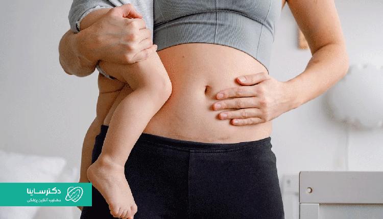 گزینههای درمانی برای کنترل خونریزی داخلی بعد از سزارین باید طبق نظر پزشک باشد.