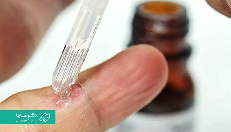 حداکثر دز مجاز اسید سالیسیلیک، با توجه به علت درمان متفاوت است.