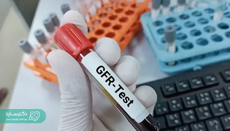 GFR تست
