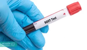SGOT Test