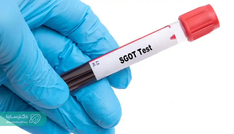 SGOT Test