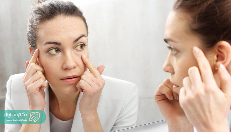 زردی چشمها، از عوارض مشکلات کبدی و کاهش آلبومین خون