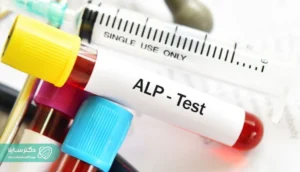 همه‌چیز درباره تست ALP