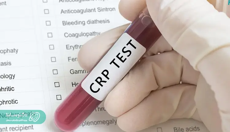 آزمایش CRP مثبت