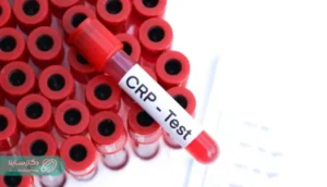 آزمایش CRP چیست؟