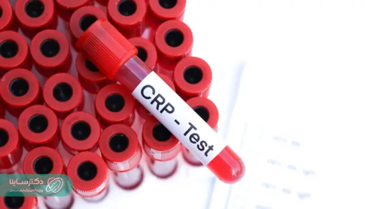 آزمایش CRP چیست؟