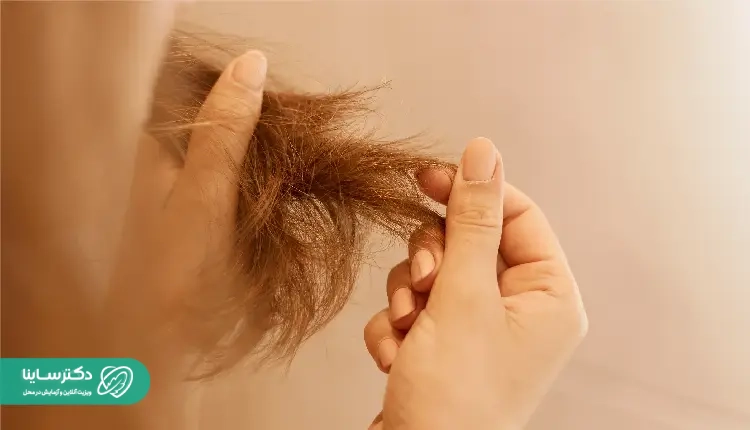 علائم ریزش مو در دوران یائسگی