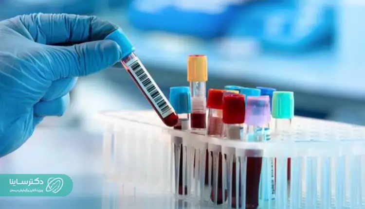 نتایج و تفسیر آزمایش RBC