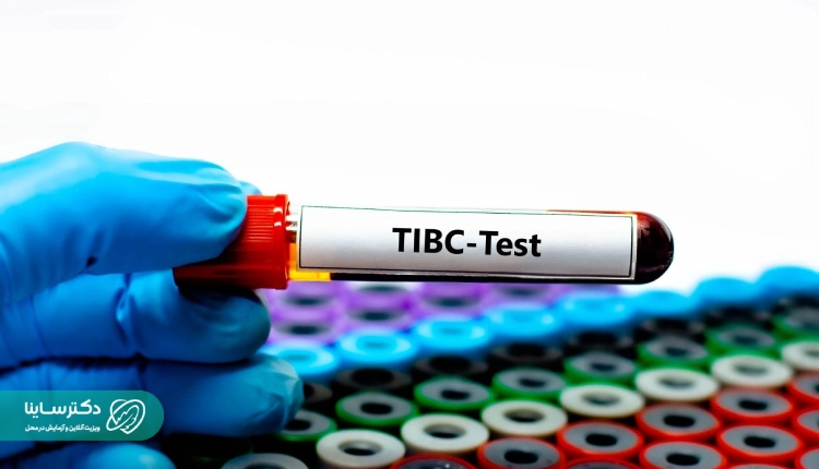 آزمایش TIBC